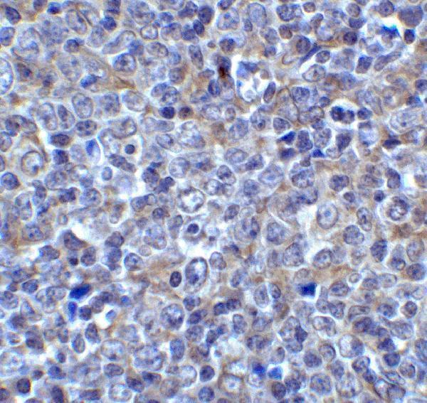 Immunohistochemistry of LAG3 in human tonsil tissue with LAG3 antibody at 5 μg/ml
