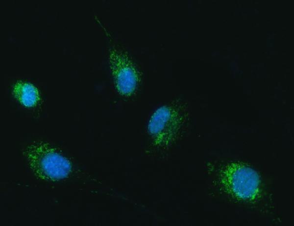 a02870 3 tfg primary antibodies if testing 8
