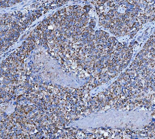 a02870 3 tfg primary antibodies ihc testing 5
