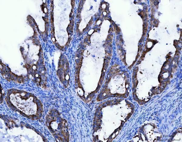 a02870 3 tfg primary antibodies ihc testing 6