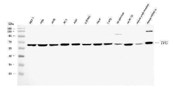  Western blot analysis of TRK fused gene/TFG using anti-TRK fused gene/TFG antibody (A02870-3)