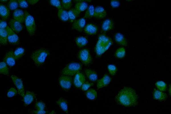  IF analysis of Eph Receptor A3/EPHA3 using anti-Eph Receptor A3/EPHA3 antibody (A02872-1)
