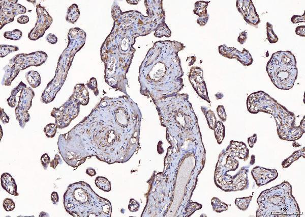  IHC analysis of Eph Receptor A3/EPHA3 using anti-Eph Receptor A3/EPHA3 antibody (A02872-1)