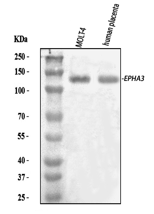  Western blot analysis of Eph Receptor A3/EPHA3 using anti-Eph Receptor A3/EPHA3 antibody (A02872-1)