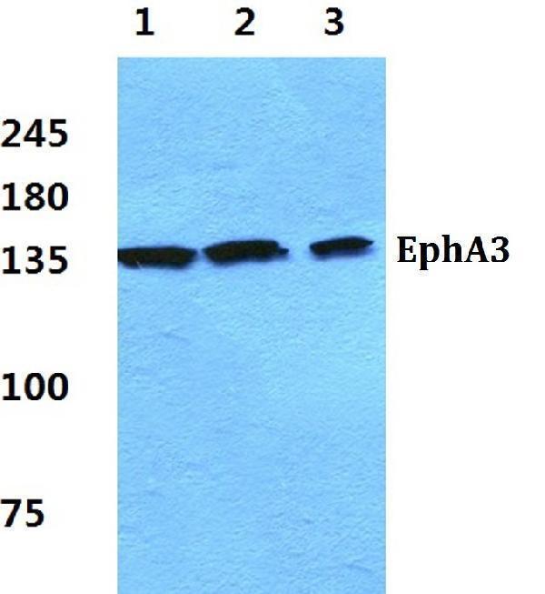 Western blot (WB) analysis of EphA3 polyclonal antibody at 1:500 dilution
Lane1:Hela cell lysate
Lane2:NIH-3T3 cell lysate
Lane3:PC12 cell lysate