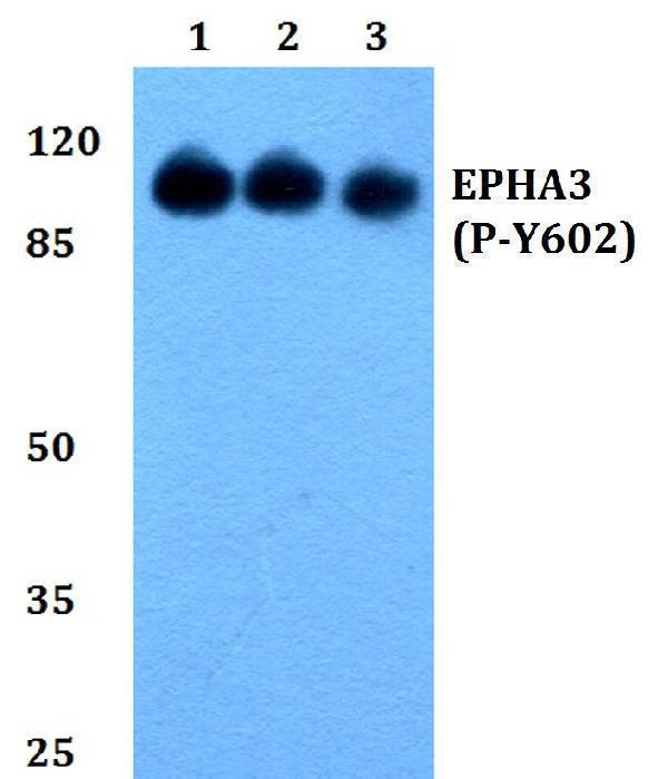 Western blot (WB) analysis of p-EphA3 (Y602) polyclonal antibody at 1:500 dilution
Lane1:HEK293Twhole cell lysate
Lane2:sp2/0 whole cell lysate
Lane3:H9C2 whole cell lysate
