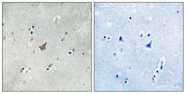 a02872y779 epha3 primary antibodies ihc testing 1
