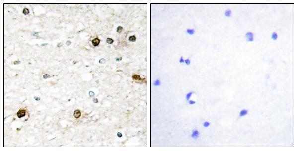 a02873 nab2 primary antibodies ihc testing 1