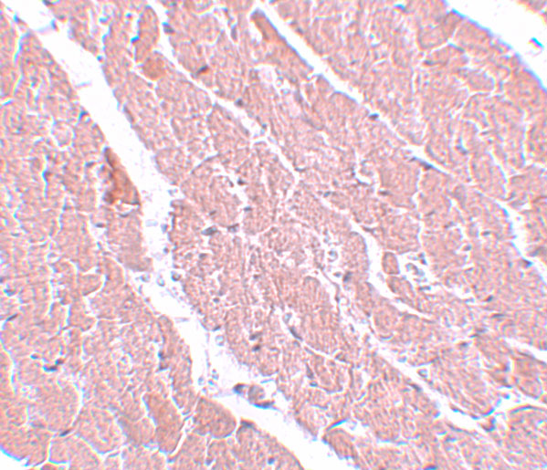 Immunohistochemistry of ATG13 in mouse heart with ATG13 antibody at 5 μg/mL