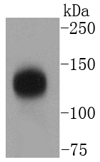 Western blot analysis of TACC3 on Hela cells lysates using anti-TACC3 antibody at 1/1,000 dilution