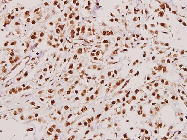 a02876t813 tacc3 primary antiboties ihc testing 2