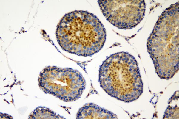 a02877 2 sox6 primary antibodies ihc testing 3