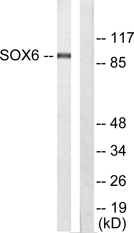 Western blot analysis of lysates from Jurkat cells, using SOX6 Antibody