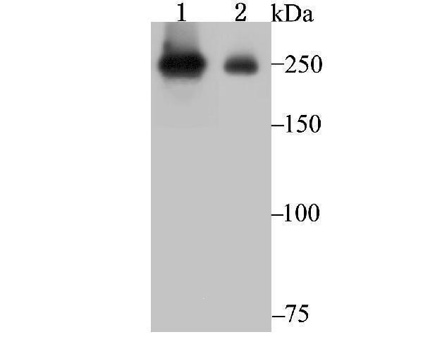 Western blot analysis of PRPF8 on SiHa (1) and A549 (2) cell lysate using anti-PRPF8 antibody at 1/1,000 dilution