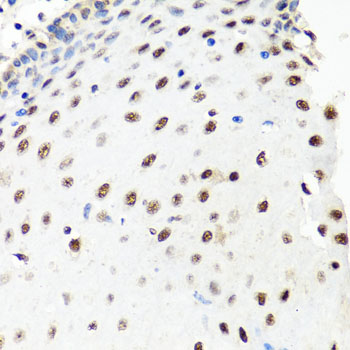 a02878 prpf8 primary antiboties ihc testing 2