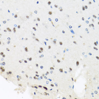 a02878 prpf8 primary antiboties ihc testing 3