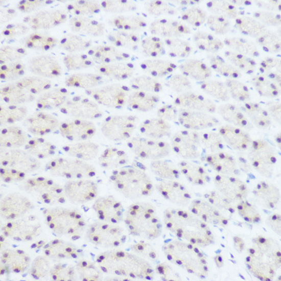 a02878 prpf8 primary antiboties ihc testing 4