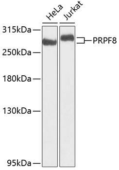 a02878 prpf8 primary antiboties wb testing 1