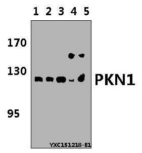 Western blot (WB) analysis of PKN1 polyclonal antibody at 1:500 dillution
Lane1:MCF-7 whole cell lysate(40μg)
Lane2:AML-12 whole cell lysate(40μg)
Lane3:BV2 whole cell lysate(40μg)
Lane4:C6 whole cell lysate(40μg) 
Lane5:H9C2 whole cell lysate(40μg)