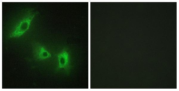 a02882 2 acvr1b primary antibodies if testing 1