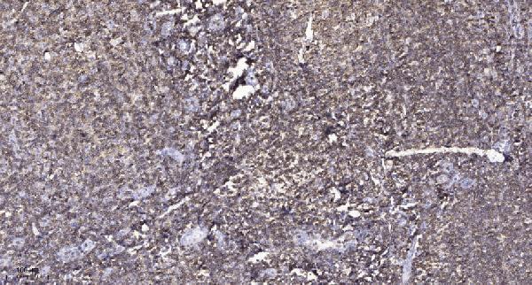 a02882 2 acvr1b primary antibodies ihc testing 4