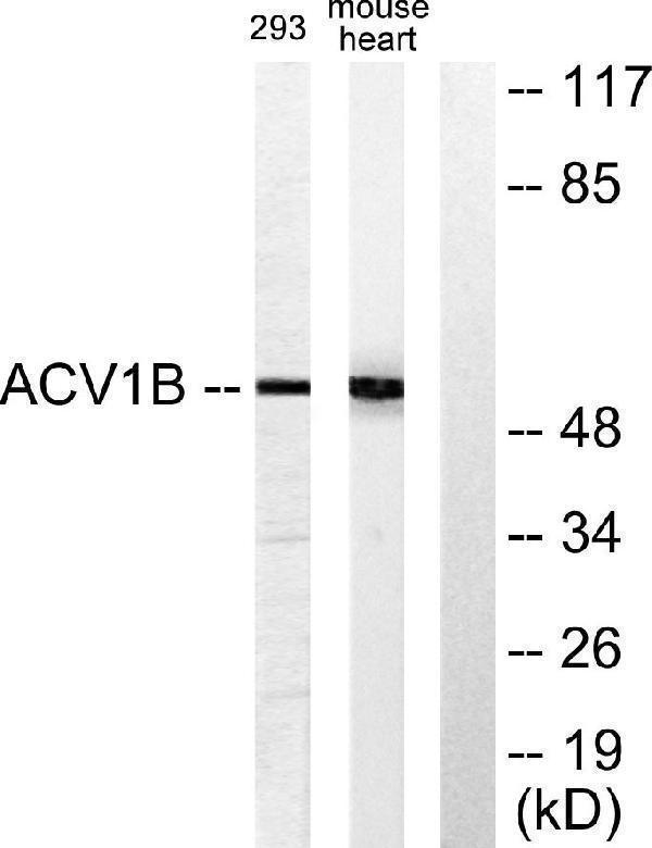 a02882 2 acvr1b primary antibodies wb testing 3