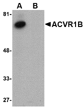 a02882 acvr1b primary antibodies wb testing 1