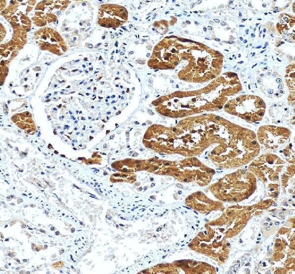 a02884 1 gk primary antibodies ihc testing 4