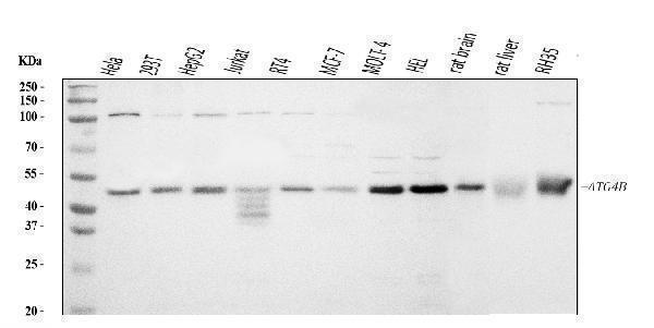  Western blot analysis of ATG4B using anti-ATG4B antibody (A02885-1)