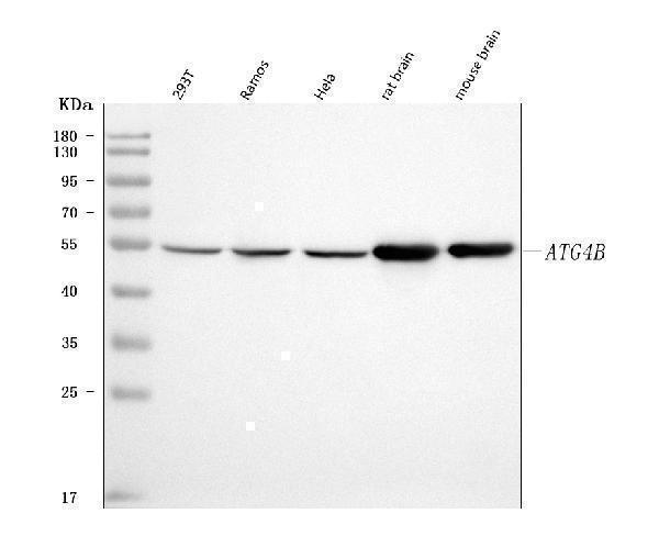  Western blot analysis of ATG4B using anti-ATG4B antibody (A02885-2)