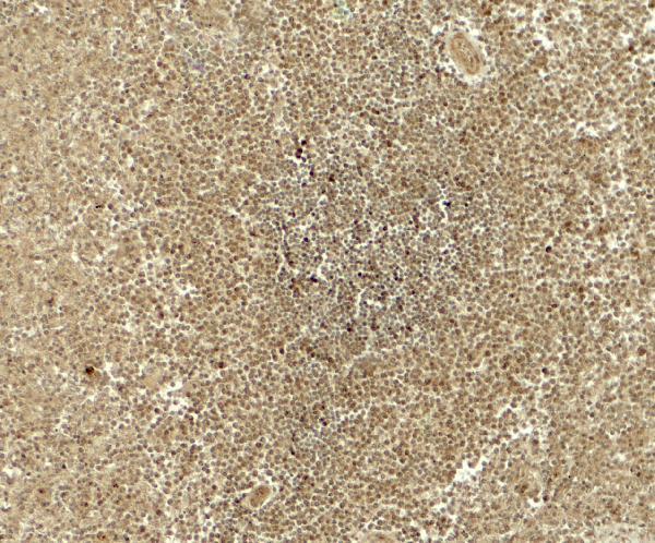Immunohistochemistry of ATG4B in human spleen tissue with ATG4B antibody at 5 μg/ml