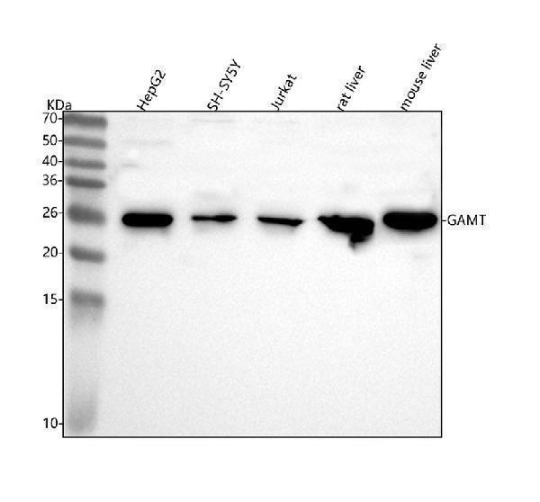  Western blot analysis of GAMT using anti-GAMT antibody (A02886-2)