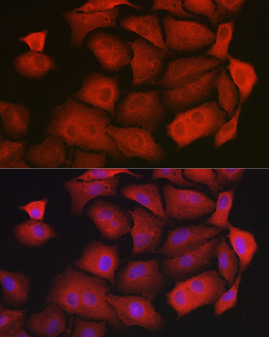 Immunofluorescence analysis of A549 cells using GAMT Rabbit pAb  at dilution of 1:200 