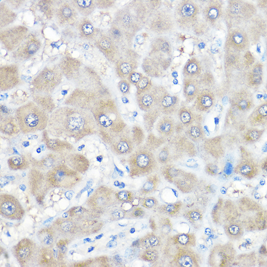 a02886 gamt primary antiboties ihc testing 2