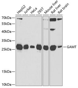 Western blot analysis of extracts of various cell lines, using GAMT antibody  at 1:1000 dilution