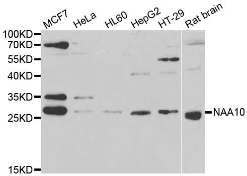 Immunohistochemistry of paraffin-embedded rat lung using NAA10 antibody  at dilution of 1:100 