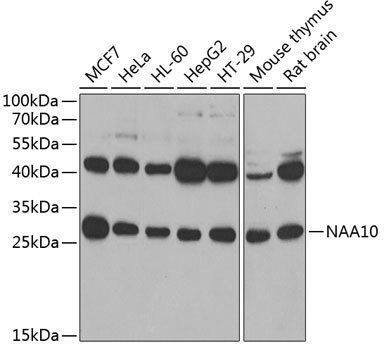 Western blot analysis of extracts of various cell lines, using NAA10 antibody  at 1:1000 dilution