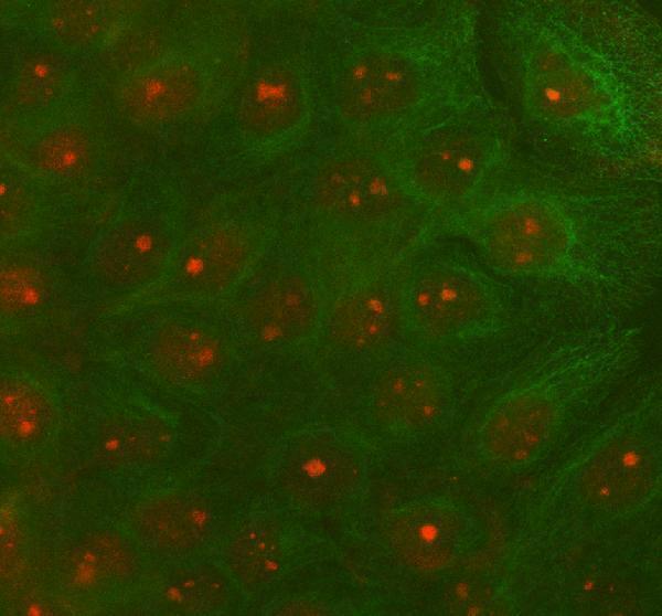  IF analysis of RAD51D using anti-RAD51D antibody (A02893-3) and anti-Beta Tubulin antibody (M01857-3)