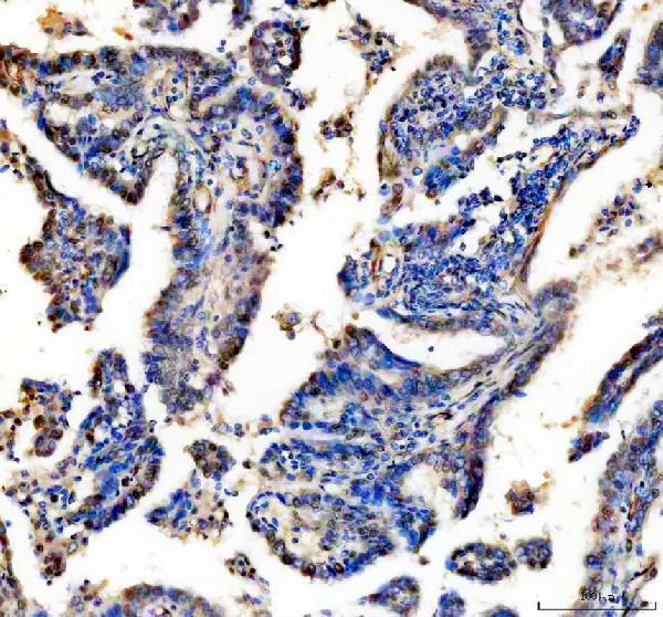 IHC analysis of RAD51D using anti-RAD51D antibody (A02893-3)