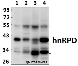 Western blot (WB) analysis of hnRPD (H79) polyclonal antibody at 1:500 dilution
Lane1:Hela whole cell lysate(40ug)
Lane2:HEK293T whole cell lysate(40ug)
Lane3:PC12 whole cell lysate(40ug)
Lane4:BV2 whole cell lysate(40ug)