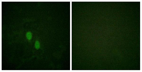 Immunofluorescence analysis of HeLa cells, using hnRPD Antibody