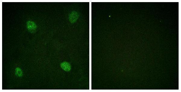 a02895s83 hnrnpd primary antibodies if testing 4