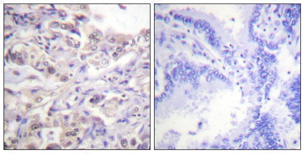 a02895s83 hnrnpd primary antibodies ihc testing 3