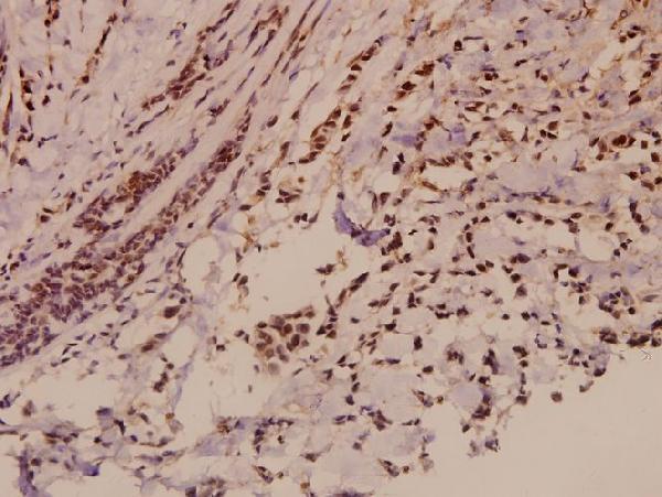 a02896 e2f2 primary antiboties ihc testing 2