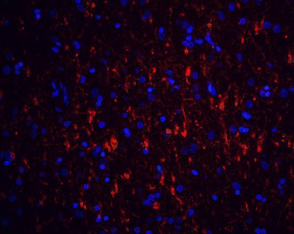 Immunofluorescence of GFR alpha 1 in human brain tissue with GFR alpha 1 antibody at 20 μg/mL
