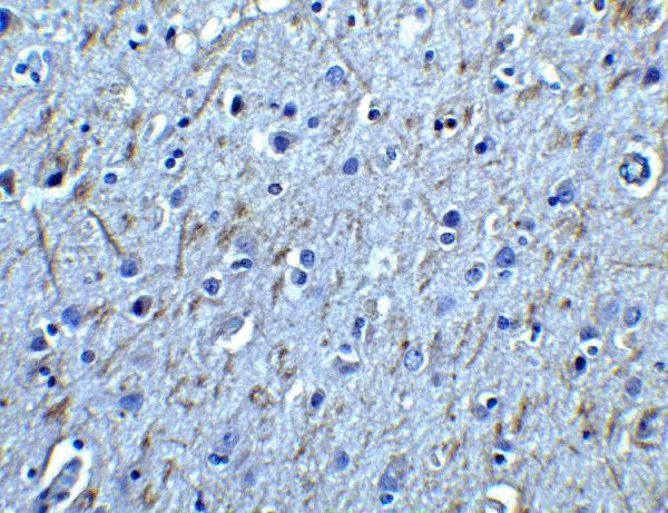 Immunohistochemistry of GFR alpha 1 in human brain tissue with GFR alpha 1 antibody at 2