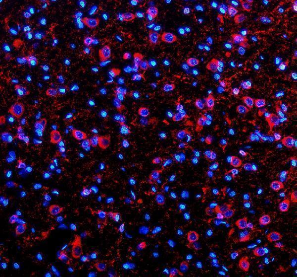 a02898 2 msi2 primary antibodies if testing 2