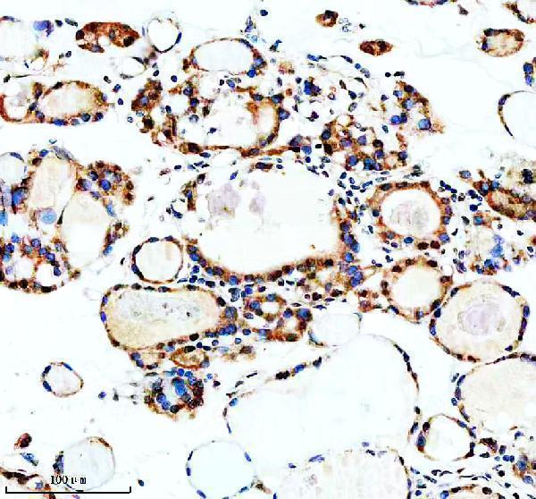 IHC analysis of MSI2 using anti-MSI2 antibody (A02898-2)