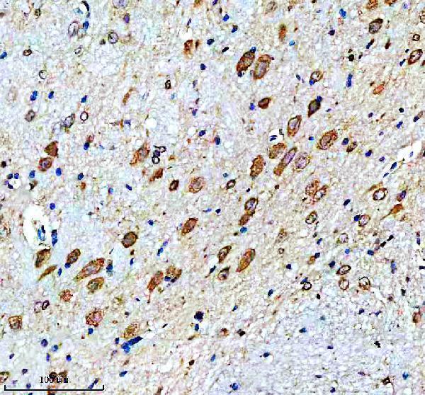IHC analysis of MSI2 using anti-MSI2 antibody (A02898-2)