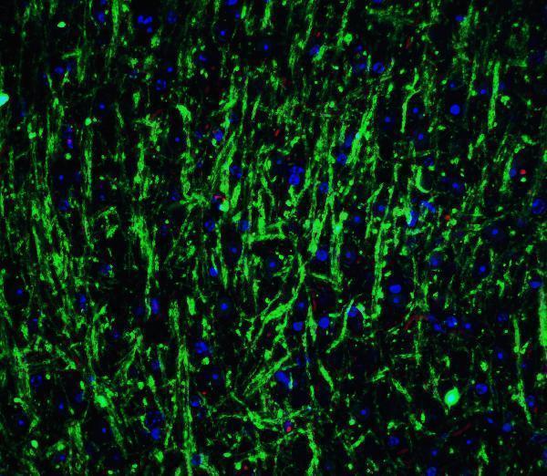 a02898 msi2 primary antibodies if testing 5